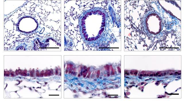 Asthma OATD-01 OATD-01 hamuje zapalenie oraz