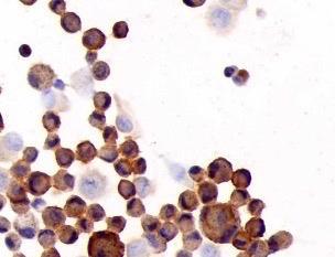 BALf Macrophages 65-75% komórek BALf (wydzielina