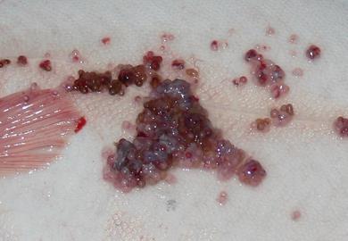 Limfocystoza w początkowym stadium infekcji objawia się powstawaniem pojedynczych drobnych guzków