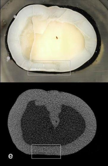 Zastosowania - porównanie obrazowania mikro-ct i histologii do wykrywania próchnicy Skąd niezgodności uzyskanych wyników?