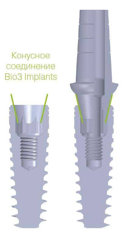 Implants zapewniają