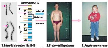kanałem potasowym) WT1 (gen nowotworu Wilms a) kspresja bialleliczna W wątrobie, mózgu i chondrocytach W