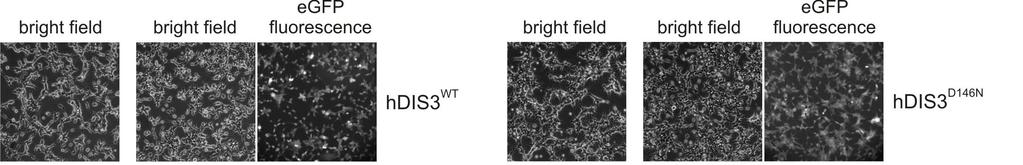 DIS3 PIN domain as a novel MM drug target Synthetic lethal interaction between hdis3 MM