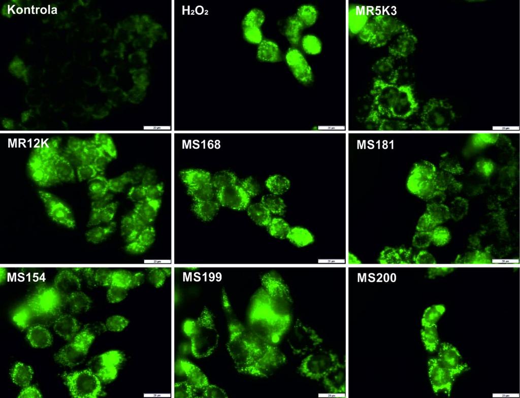 2.2 Wpływ TSC na generowanie reaktywnych form tlenu W celu zbadania możliwości generowania ROS przez pochodne tiosemikarbazonu przeprowadzono test fluorescencyjny.