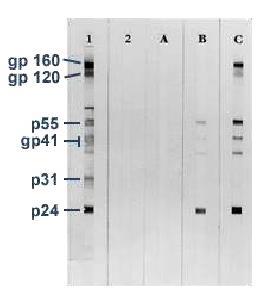 Western Blot HIV-1 Western Blot Lane 1: Positive Control Lane 2: