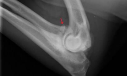 Radiologiczna ocena dysplazji stawów łokciowych u psów 8 biegnie w płaszczyźnie strzałkowej, więc nie jest widoczna na zdjęciach bocznych [4].