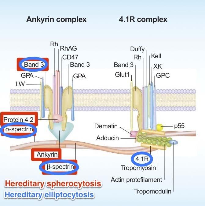 Sferocytoza rodzinna Defekt dotyczy szkieletu utrzymującego błonę komórkową erytrocyta (ankyryna, rzadziej α lub β spektryny) w wyniku czego dochodzi do utraty części błony komórkowej i