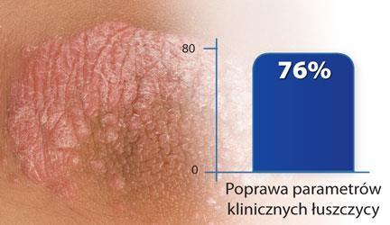 Niedobory odporności Łuszczyca i RZS Bardzo znacząca poprawa parametrów klinicznych łuszczycy u 76% pacjentów, efektem stosowania: 12 kapsułek