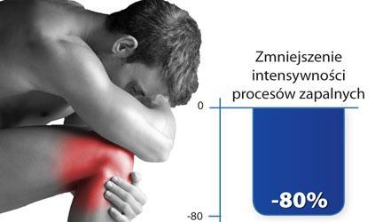 80% obniżenie intensywności procesów zapalnych i poważna poprawa zdrowia u pacjentów z reumatoidalnym zapaleniem stawów, efektem stosowania: prof.