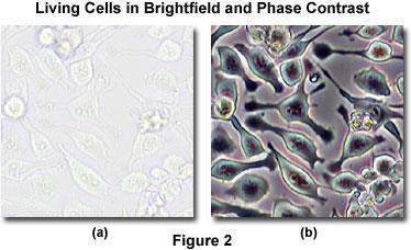 A comparison of living cells in culture imaged in both brightfield and phase contrast illumination.