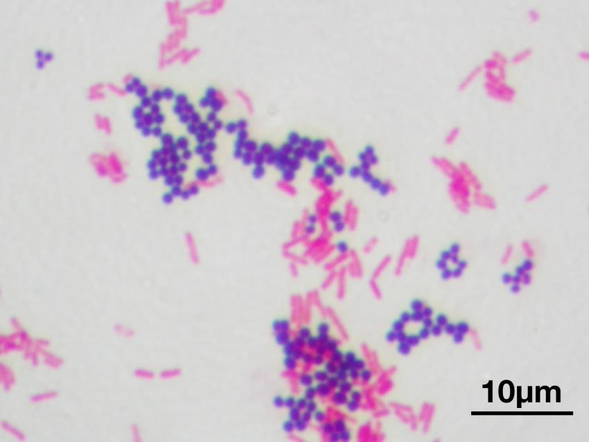 Obraz Gram-dodatnich bakterii Staphylococcus aureus ATCC 25923 (fioletowe) i