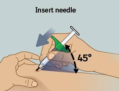 8) Wbić igłę Trzymać strzykawkę pod kątem około 45 stopni do miejsca wstrzyknięcia, a