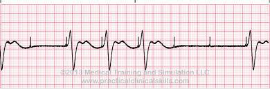 EKG - holterowskie 4.