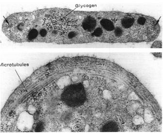 organelle i ziarna - glikogen gruby glikokaliks mikrotubule glikogen hialomer granulomer