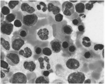 Komórki o podobnej morfologii Rozmaz