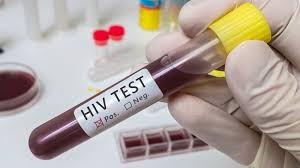 Jak i gdzie zrobić test na HIV Żeby wykluczyć zakażenie HIV trzeba zrobić test minimum 12 tygodni po sytuacji, podczas której mogło dojść do zakażenia.
