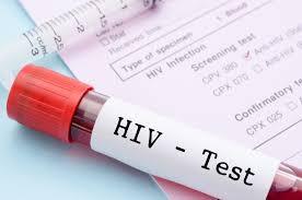 Jak i gdzie zrobić test na HIV w woj. łódzkim PKD przy Laboratorium Diagnostyka ul.