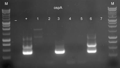 DNA wyizolowane z mikroorganizmów obecnych w kleszczach Wewnętrzny PCR (ang. nested PCR) wykonany na matrycy DNA wyizolowanego z kleszczy pospolitych.