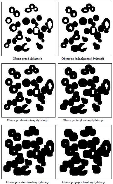 Przekształcenia morfologiczne (5) Dylatacja Przeciwieństwo erozji Jeżeli punkt centralny i otoczenie elementu strukturalnego zgadza się z lokalną konfiguracją punktów obrazu, to nowa wartość punktu