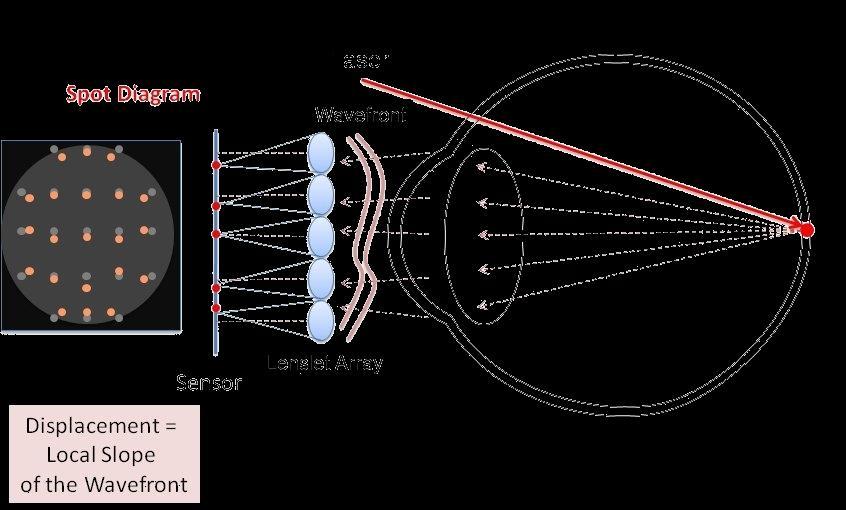 SH w optometrii Detektory Shacka-Hartmanna są stosowane w optometrii do mierzenia aberracji układu optycznego oka.
