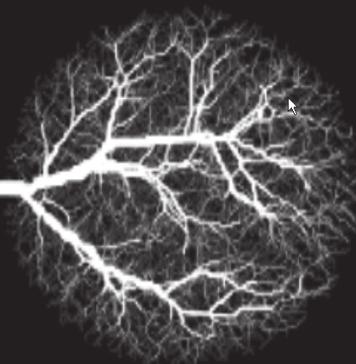 czącej układu krwionośnego mózgu, odwzorowanej w atlasach anatomicznych [8].