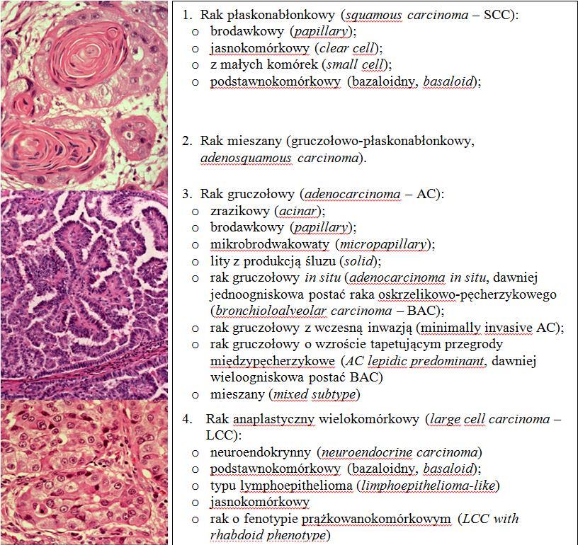 Rozpoznanie histologiczne niedrobnokomórkowego raka