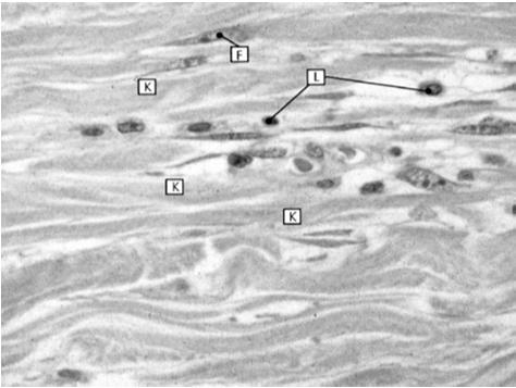 zbita (włóknista): spoczynkowe fibroblasty zwarty układ włókien