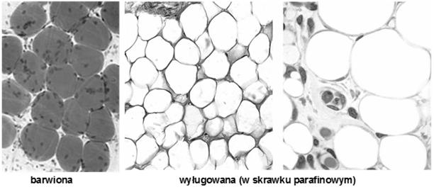 żółta: adipocyty jednopęchrzykowe (zwarty układ) niewiele istoty