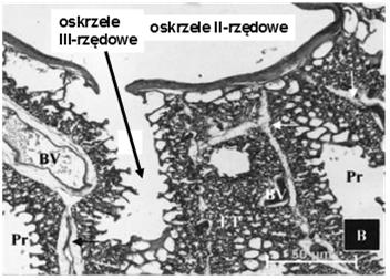 kość (kładka) Oskrzela I-rzędowe podkowy chrzęstne przechodzące w płytki chrzęstne nabłonek dróg oddechowych okrężna