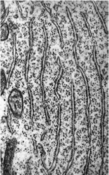 neurotubul neurotubule (= mikrotubule) Tak dobrze rozwinięty aparat syntezy białek jest w komórce nerwowej