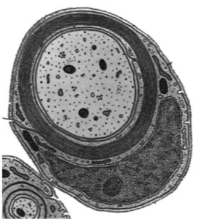 osłonki) Aksony pozbawione osłonki mielinowej mają regularnie rozmieszczone kanały sodowe i