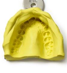 Orthoprint Masa alginatowa dla ortodontów Systemy wyciskowe / Wycisk wstępny Orthoprint jest specjalną masą alginatową dla ortodontów, która łączy precyzję i praktyczność.