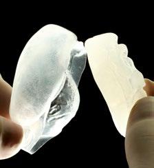 Wysoka przejrzystość i odpowiedni czas pracy sprawiają, że Elite Glass jest szczególnie skuteczny w przypadku różnych sytuacji klinicznych: do tworzenia form bezpośrednio w ustach pacjenta (np.