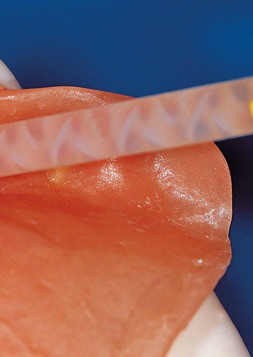 Systemy wyciskowe Podścielenia Aby poprawnie dostosować protezę do błony śluzowej, utrzymać stabilność i zachować funkcjonalność ustną, Zhermack oferuje materiały do wykonania podścielenia protez