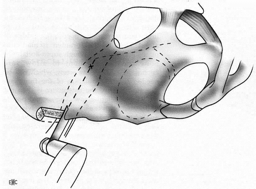 9. KROK