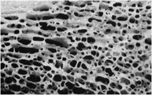 nadtrawionych fragmentów trawienie wewnątrzkomórkowe w lizosomach
