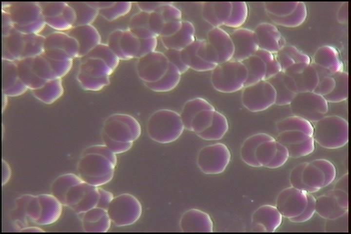 BEFORE (PRZED) AFTER (PO) - acidification