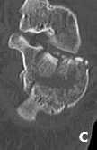 Ryc. 36.