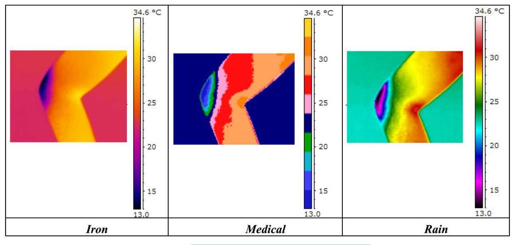 Termogram w