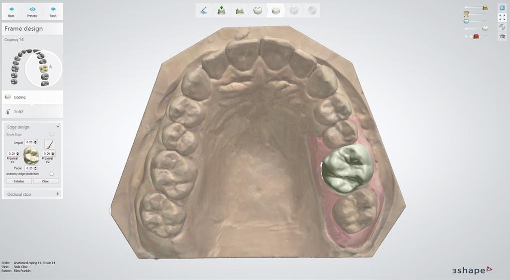 Zoptymalizowany interfejs użytkownika narzędzia Dental Designer na lewym panelu Oprogramowanie Dental System 2015 optymalizuje pracę poprzez zmieniony, bardziej przyjazny dla