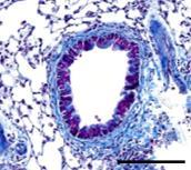 cytokiny CCL4 inicjującej proces zapalny i