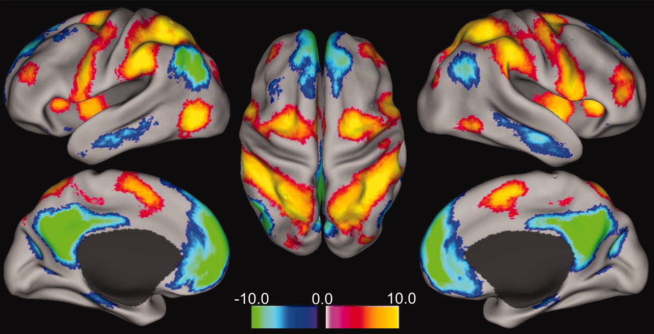 aktywnością struktur wchodzących w skład żółto-czerwonych plam zastosowanie analizy seed-based do resting state Fox