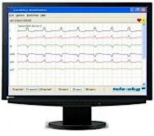 Elementy oprogramowania CardioScp (wersja sieciowa): Serwer aplikacja zarządzająca bazą danych oparta o MS SQL Express