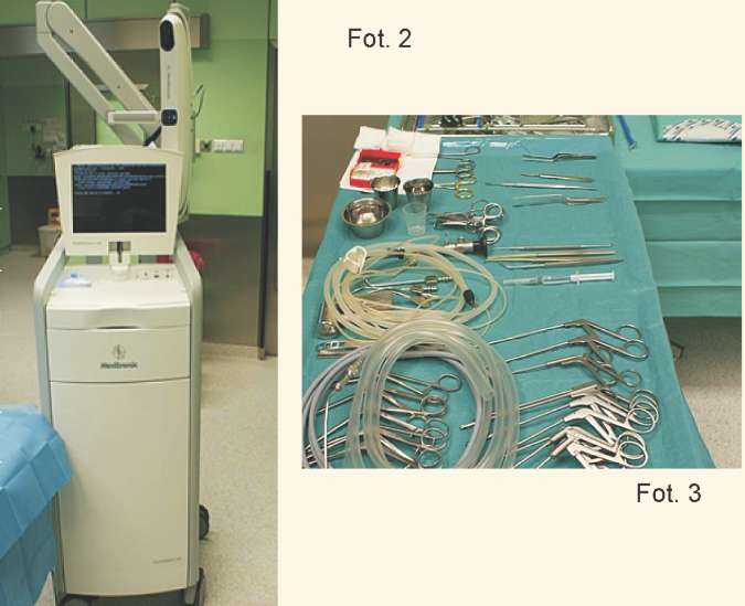 KONFERENCJE KONFERENCJE I Może też być potrzebna neuronawigacja (fot.2) używana przy zabiegach endoskopowych przedniego dołu czaszki.
