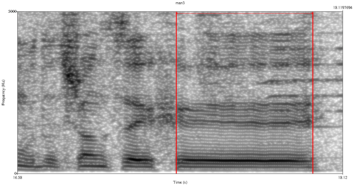 2.2. Algorytmy detekcji artefaktów 17 Rysunek 2.4: Spektrogram fragmentu wypowiedzi zawierający artefakt czy aaa.