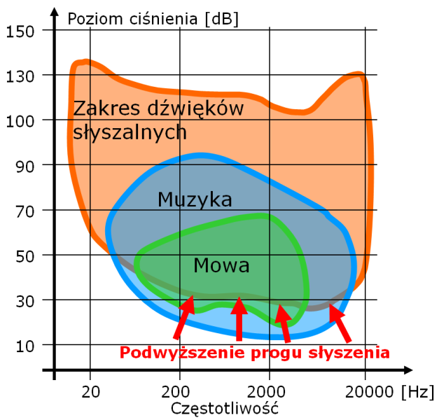 Rys. 5. Obszar dźwięków słyszalnych oraz obszary muzyki i mowy dla osoby ze słuchem prawidłowym. Rys. 6. Obszar dźwięków słyszalnych oraz obszary muzyki i mowy dla osoby ze słuchem uszkodzonym.