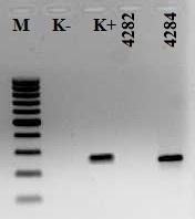 Metody badawcze Test antygen przeciwciało ELISA a) ELISA 4. generacji próbki 1.