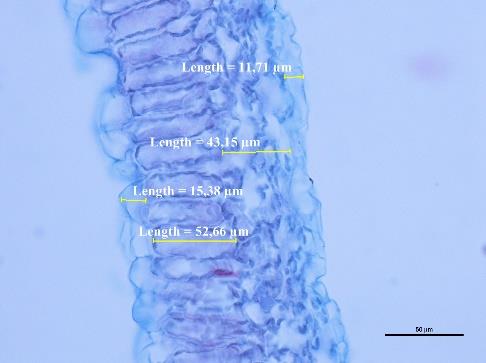 Fot. 8-17 Zmiany w morfologii liści ogórka zainfekowanego Pseudoperonospora cubensis (Berk & M.A. Curtis) Rostovzev.