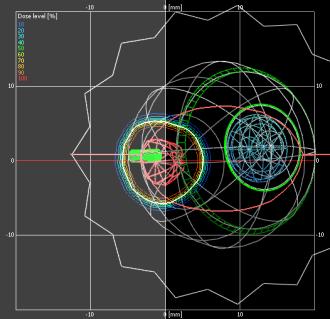 Bajer Ocular Treatment Planning