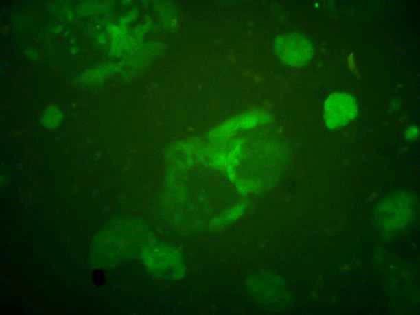 A B pips-gfp C D pips-tk E F G pips-gfp (UbC) 75% Rycina 43. Wyprowadzone linie komórkowe pips-gfp (A i B) i pips-tk (C i D) traciły ekspresję transgenów w wyniku wyciszania promotora CMV.